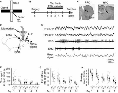 Characterization of Peripheral Activity States and Cortical Local Field Potentials of Mice in an Elevated Plus Maze Test